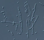 Kluyveromyces_aestuarii_ATCC_18862