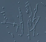 Kluyveromyces_aestuarii_ATCC_18862