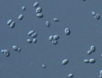 Kluyveromyces_wickerhamii_UCD_54_210