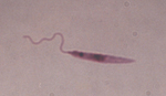 Leishmania_donovani_BHU_1220