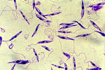 Leishmania_infantum