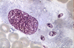 Leishmania_major_LV39c5