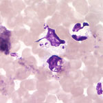 Leishmania_panamensis_MHOM_COL_81_L13