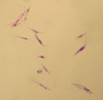 Leishmania_tropica_L590