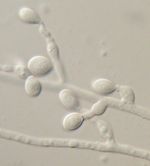 Lomentospora_prolificans_JHH_5317