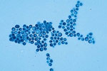 Malassezia_globosa_CBS_7966
