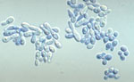 Malassezia_sympodialis_ATCC_44340