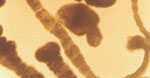 Mesocestoides_corti