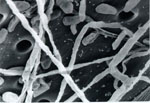 Metarhizium_anisopliae_BRIP_53293