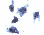 Naegleria_fowleri