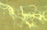 Neocallimastix_patriciarum