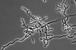 Ophidiomyces_ophiodiicola_MYCO_ARIZ_AN0400001