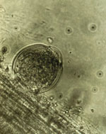 Orpinomyces_sp__C1A