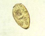 Paragonimus_westermani