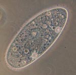 Paramecium_aurelia
