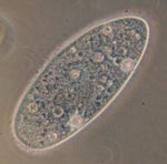 Paramecium_aurelia