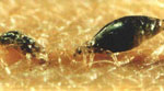 Pediculus_humanus_corporis_str__USDA