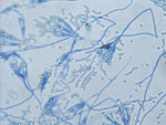 Penicillium_aurantiogriseum_NRRL_62431