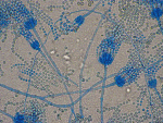 Penicillium_bilaiae_ATCC_20851