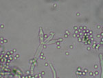 Penicillium_glabrum_DAOM_239074