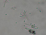 Penicillium_oxalicum_114_2