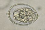 Phytophthora_cactorum_LV007