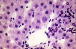 Plasmodium_cynomolgi_strain_B