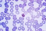 Plasmodium_malariae