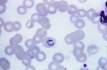 Plasmodium_ovale