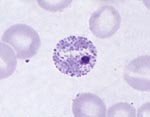 Plasmodium_vivax