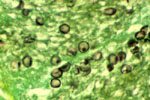 Pneumocystis_carinii