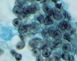 Pneumocystis_jirovecii_E2178