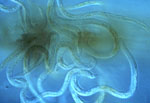 Pratylenchus_penetrans