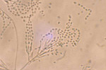 Purpureocillium_lilacinum_36_1