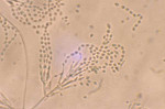 Purpureocillium_lilacinum_TERIBC_1