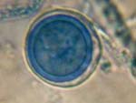 Pythium_ultimum_DAOM_BR144