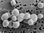 Saccharomyces_bayanus_623_6C