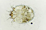 Sarcoptes_scabiei_type_canis