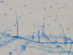 Sarocladium_strictum_DS1bioAY4a