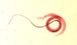 Schistosoma_haematobium