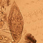 Schistosoma_intercalatum