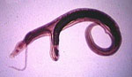 Schistosoma_japonicum