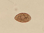 Spirometra_erinaceieuropaei