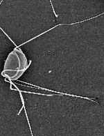 Spironucleus_vortens