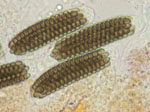 Sporormia_fimetaria