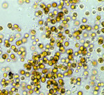 Symbiodinium_kawagutii