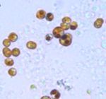 Symbiodinium_sp__A1