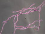 Thermothelomyces_thermophila_ATCC_42464