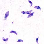 Toxoplasma_gondii_ARI