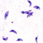 Toxoplasma_gondii_TgCatPRC2